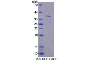 SDS-PAGE analysis of Human TECTb Protein. (TECTB 蛋白)