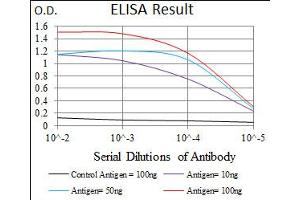 Image no. 1 for anti-E2F Transcription Factor 1 (E2F1) antibody (ABIN1491636) (E2F1 抗体)