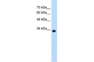 Western Blot showing ZMYND11 antibody used at a concentration of 1-2 ug/ml to detect its target protein. (ZMYND11 抗体  (N-Term))