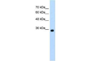 Western Blotting (WB) image for anti-Zinc Finger, MYND-Type Containing 11 (ZMYND11) (N-Term) antibody (ABIN925795)