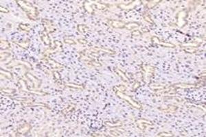 Immunohistochemistry analysis of paraffin-embedded rat kidney using,Fastkd3 (ABIN7073917) at dilution of 1: 3000 (FASTKD3 抗体)