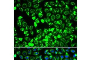 Immunofluorescence analysis of HeLa cells using DLD Polyclonal Antibody (DLD 抗体)
