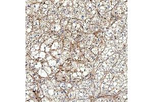 IHC analysis of PTRF/CAVIN1 using anti-PTRF/CAVIN1 antibody (ABIN7601817). (PTRF 抗体  (AA 47-390))