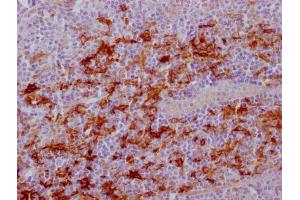 IHC image of ABIN7181209 diluted at 1:100 and staining in paraffin-embedded human tonsil tissue performed on a Leica BondTM system. (Fascin 抗体)