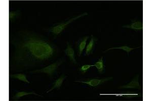 Immunofluorescence (IF) image for anti-Proliferating Cell Nuclear Antigen (PCNA) (AA 78-177) antibody (ABIN518693)