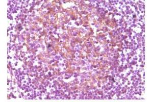 Immunohistochemical analysis of paraffin-embedded human lymphnode, showing membrane localization using CD14 mouse mAb with DAB staining. (CD14 抗体)