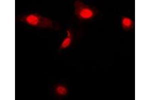 Immunofluorescent analysis of Galectin 3 staining in Jurkat cells. (Galectin 3 抗体  (Center))