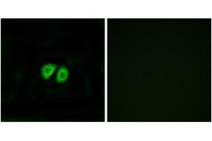 Immunofluorescence analysis of MCF7 cells, using GPR56 Antibody. (GPR56 抗体  (AA 251-300))