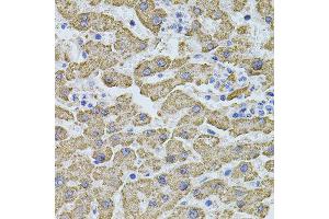 Immunohistochemistry of paraffin-embedded human liver injury using PHF1 antibody (ABIN5974685) at dilution of 1/100 (40x lens). (PHF1 抗体)