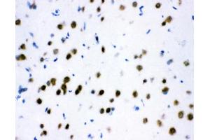IHC testing of frozen rat brain tissue with ATF2 antibody at 1ug/ml. (ATF2 抗体  (AA 93-450))