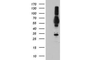 Western Blotting (WB) image for anti-Tubby Like Protein 3 (TULP3) antibody (ABIN1501585) (TULP3 抗体)