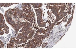 Immunohistochemistry (IHC) image for anti-Chemokine (C-X-C Motif) Receptor 7 (CXCR7) antibody (ABIN2857021)