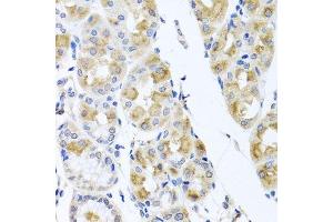 Immunohistochemistry of paraffin-embedded human stomach using TMEM43 antibody. (TMEM43 抗体  (AA 80-310))