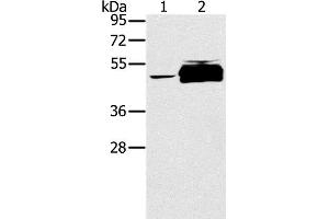 Western Blot analysis of K562 cell and Human testis tissue using PTPN20 Polyclonal Antibody at dilution of 1:200 (PTPN20 抗体)