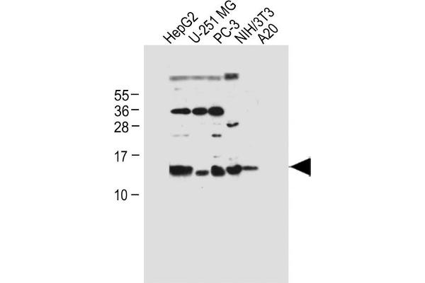 Selenoprotein K anticorps  (AA 32-61)