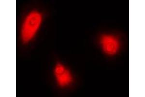 Immunofluorescent analysis of CUGBP1 staining in HeLa cells. (CELF1 抗体  (Center))