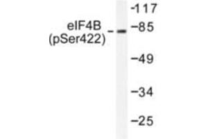 Image no. 1 for anti-Eukaryotic Translation Initiation Factor 4B (EIF4B) (pSer422) antibody (ABIN782456)