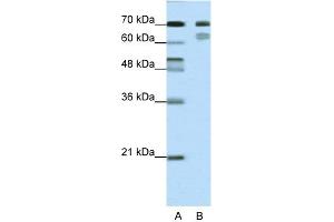 WB Suggested Anti-TCF3 Antibody Titration:  0. (TCF3 抗体  (N-Term))