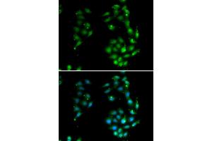 Immunofluorescence analysis of U20S cell using SOX5 antibody. (SOX5 抗体)