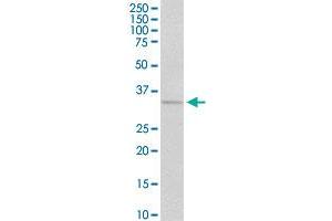 CCND1 MaxPab polyclonal antibody. (Cyclin D1 抗体  (AA 1-295))