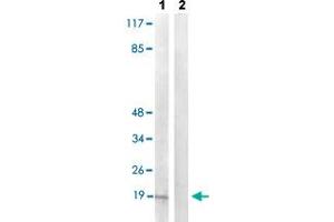 Western blot analysis of Lane 1: TNF treated COS-7 cells, Lane 2: antigen-specific peptide treated COS-7 cells with PEA15 (phospho S104) polyclonal antibody  at 1:500-1:1000 dilution. (PEA15 抗体  (pSer104))