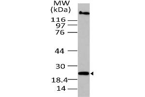 Image no. 1 for anti-Oxidized Low Density Lipoprotein (Lectin-Like) Receptor 1 (OLR1) (AA 1-200) antibody (ABIN5027116) (OLR1 抗体  (AA 1-200))