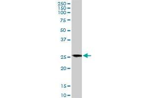 BCAP31 monoclonal antibody (M01A), clone 3C5. (BCAP31 抗体  (AA 137-246))