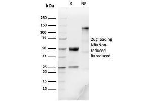 SDS-PAGE Analysis Purified IgM Recombinant Rabbit Monoclonal Antibody (IGHM/3776R). (Recombinant IGHM 抗体)