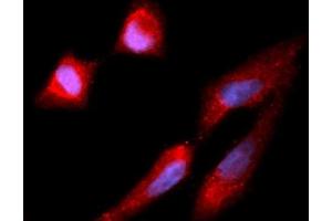 Immunofluorescence (IF) image for anti-Carboxypeptidase E (CPE) (AA 43-476) antibody (APC) (ABIN5565194)