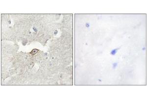 Immunohistochemistry analysis of paraffin-embedded human brain tissue using LMTK2 antibody. (LMTK2 抗体  (Internal Region))