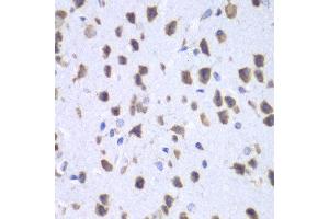 Immunohistochemistry of paraffin-embedded mouse brain using UPF1 antibody at dilution of 1:100 (x40 lens). (RENT1/UPF1 抗体)