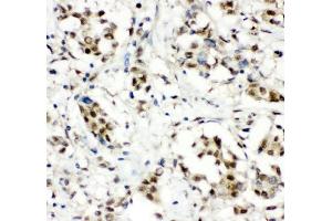 IHC analysis of CCT3 using anti-CCT3 antibody (ABIN4886513).
