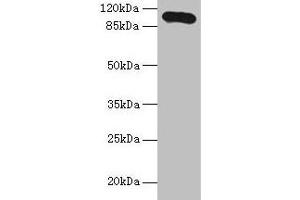 Western blot All lanes: Thbs3 antibody at 16 μg/mL + HepG2 whole cell lysate Secondary Goat polyclonal to rabbit IgG at 1/10000 dilution Predicted band size: 105 kDa Observed band size: 105 kDa (THBS3 抗体  (AA 24-350))