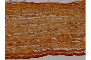 IHC image of ABIN7154440 diluted at 1:30 and staining in paraffin-embedded human skeletal muscle tissue performed on a Leica BondTM system. (GRAP 抗体  (AA 1-217))