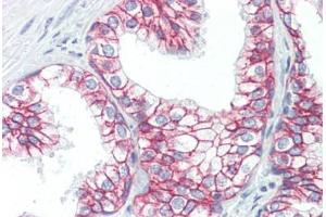 Human Prostate (formalin-fixed, paraffin-embedded) stained with CTNNB1 antibody ABIN364501 at 10 ug/ml followed by biotinylated anti-mouse IgG secondary antibody ABIN481714, alkaline phosphatase-streptavidin and chromogen. (CTNNB1 抗体  (C-Term))