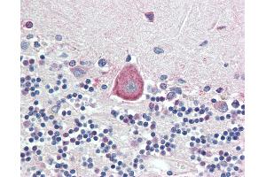 Anti-HOXA10 antibody IHC staining of human brain, cerebellum. (HOXA10 抗体  (AA 152-165))