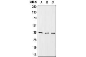 Western blot analysis of RASSF2 expression in HeLa (A), NIH3T3 (B), H9C2 (C) whole cell lysates. (RASSF2 抗体  (Center))