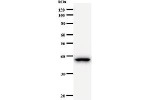 Western Blotting (WB) image for anti-B-Cell CLL/lymphoma 9 (BCL9) antibody (ABIN931006)
