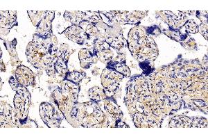 Immunohistochemistry (IHC) image for anti-Collagen, Type I, alpha 1 (COL1A1) (AA 1218-1440) antibody (ABIN7425806)