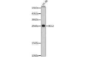 Western blot analysis of extracts of HL-60 cells using Bcl-2 Polyclonal Antibody at dilution of 1:500.