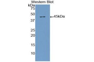 Western blot analysis of the recombinant protein. (beta-Thromboglobulin 抗体  (AA 1-119))