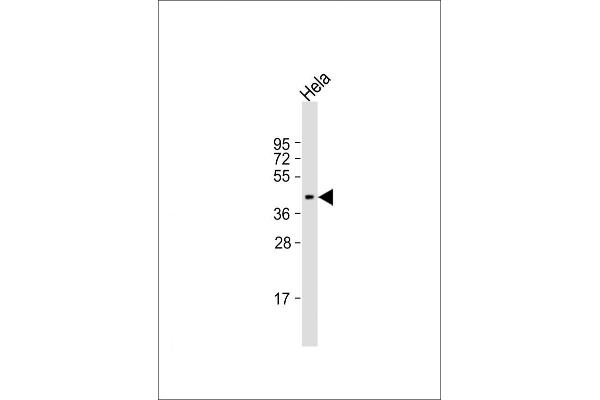 NUDT9 抗体  (C-Term)