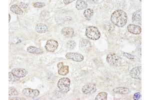 Immunohistochemistry (IHC) image for anti-Nucleoporin 50kDa (NUP50) (AA 418-468) antibody (ABIN7448703) (NUP50 抗体  (AA 418-468))