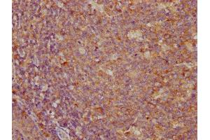 Immunohistochemistry (IHC) image for anti-CD274 (PD-L1) (AA 19-238) antibody (ABIN7164674)