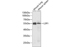 Western blot analysis of extracts of various cell lines, using LSP1 antibody (ABIN6130532, ABIN6143368, ABIN6143370 and ABIN6221252) at 1:1000 dilution. (LSP1 抗体  (AA 1-339))