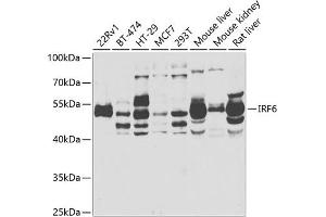 Western blot analysis of extracts of various cell lines, using IRF6 antibody  at 1:1000 dilution.