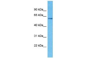 Host:  Rabbit  Target Name:  KLHL3  Sample Type:  Breast Tumor lysates  Antibody Dilution:  1. (KLHL3 抗体  (N-Term))