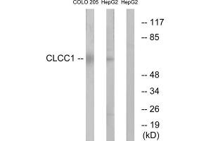 Western blot analysis of extracts from COLO cells and HepG2 cells, using CLCC1 antibody. (CLCC1 抗体  (Internal Region))