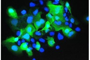 IF analysis of Psoriasin using anti-Psoriasin antibody (ABIN5692925). (S100A7 抗体  (AA 2-101))