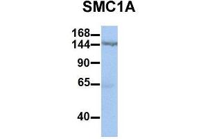 Host:  Rabbit  Target Name:  SMC1A  Sample Type:  Human HepG2  Antibody Dilution:  1. (SMC1A 抗体  (C-Term))